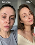 Serum do twarzy z PDRN i peptydami TVLV – wygładzenie zmarszczek, jędrność i efekt glass skin, 30 ml