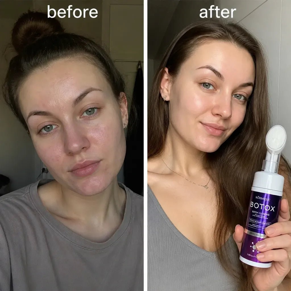 Pianka oczyszczająca do twarzy Kormesic Botox – 150 ml