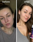 Pianka oczyszczająca do twarzy Kormesic Botox – 150 ml
