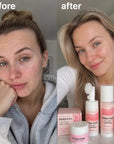 Zestaw do pielęgnacji twarzy PDRN Pink 4w1 – PDRN, kolagen, peptydy i witamina B12