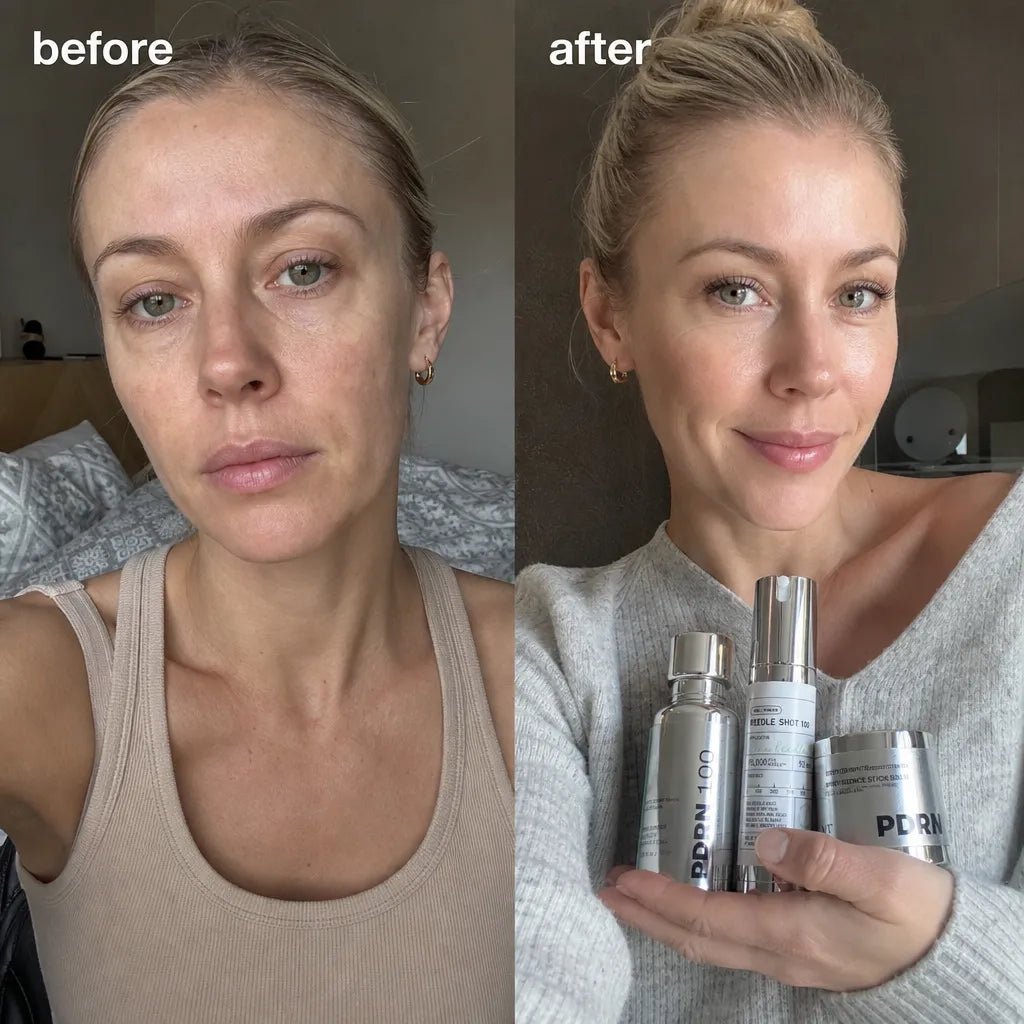 VT Cosmetics sejas kopšanas komplekts – Reedle Shot 100, PHYTO PDRN Essence 100 un PDRN Essence Stick Balm