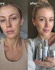 VT Cosmetics sejas kopšanas komplekts – Reedle Shot 100, PHYTO PDRN Essence 100 un PDRN Essence Stick Balm