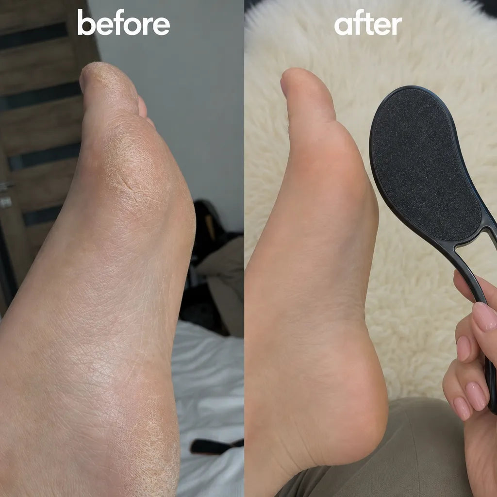 Терка для п’ят Foot Grinding Artifact — пилка для стоп, що розгладжує