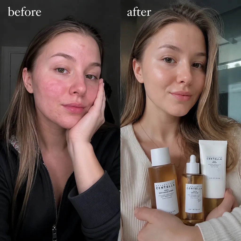 Zestaw do pielęgnacji twarzy SKIN1004 Madagascar Centella Tea-Trica – toner, ampułka i krem - Zestawy do twarzy