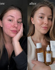 Zestaw do pielęgnacji twarzy SKIN1004 Madagascar Centella Tea-Trica – toner, ampułka i krem - Zestawy do twarzy