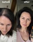 KORMESIC Minoxidil 5% kapsułki do pielęgnacji włosów z biotyną serum na porost włosów 15 ml - Kapsułki do włosów