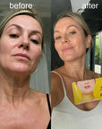 Maska na krk 24K Gold KORMESIC – 30 g
