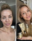 KORMESIC 24K Gold veido priežiūros rinkinys – 6 produktai