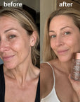 SADOER Retinol-Augenserum in Kapseln – Kollagen und Niacinamid, 45 Kapseln