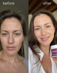Pleťový krém Dr.Melaxin Cemenrete Calcium Intense Cream – zpevnění, 50 ml