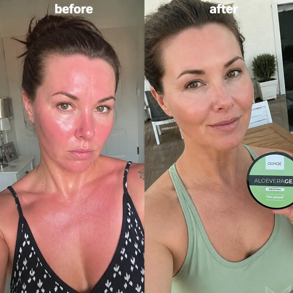 Żel aloesowy do ciała OUHOE Aloe Vera Gel – chłodzące nawilżenie po opalaniu i regeneracja skóry - Żele do ciała