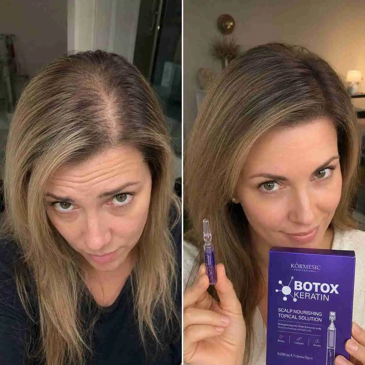 Kuracja do skóry głowy Botox Keratin – ampułki wzmacniające cebulki włosów 10 × 1,5 ml