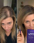 Kuracja do skóry głowy Botox Keratin – ampułki wzmacniające cebulki włosów 10 × 1,5 ml