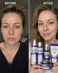 Zestaw do pielęgnacji twarzy Kormesic Botoks Collagen 5D – przeciwzmarszczkowa pielęgnacja, 5 produktów - Zestawy do twarzy