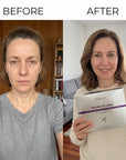 Zestaw do pielęgnacji twarzy Kormesic Botoks Collagen 5D – przeciwzmarszczkowa pielęgnacja, 5 produktów - Zestawy do twarzy