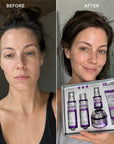 Zestaw do pielęgnacji twarzy Kormesic Botoks Collagen 5D – przeciwzmarszczkowa pielęgnacja, 5 produktów - Zestawy do twarzy