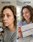Zestaw do pielęgnacji twarzy Kormesic Botoks Collagen 5D – przeciwzmarszczkowa pielęgnacja, 5 produktów - Zestawy do twarzy