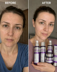 Zestaw do pielęgnacji twarzy Kormesic Botoks Collagen 5D – przeciwzmarszczkowa pielęgnacja, 5 produktów - Zestawy do twarzy