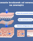 Krem do usuwania Pieprzyków i Brodawek skórnych