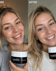 Proszek do wybielania zębów Kormesic Probiotic – 4 warianty do wyboru