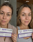 Serum do twarzy w ampułkach Kormesic Botox Collagen – 7 ampułek