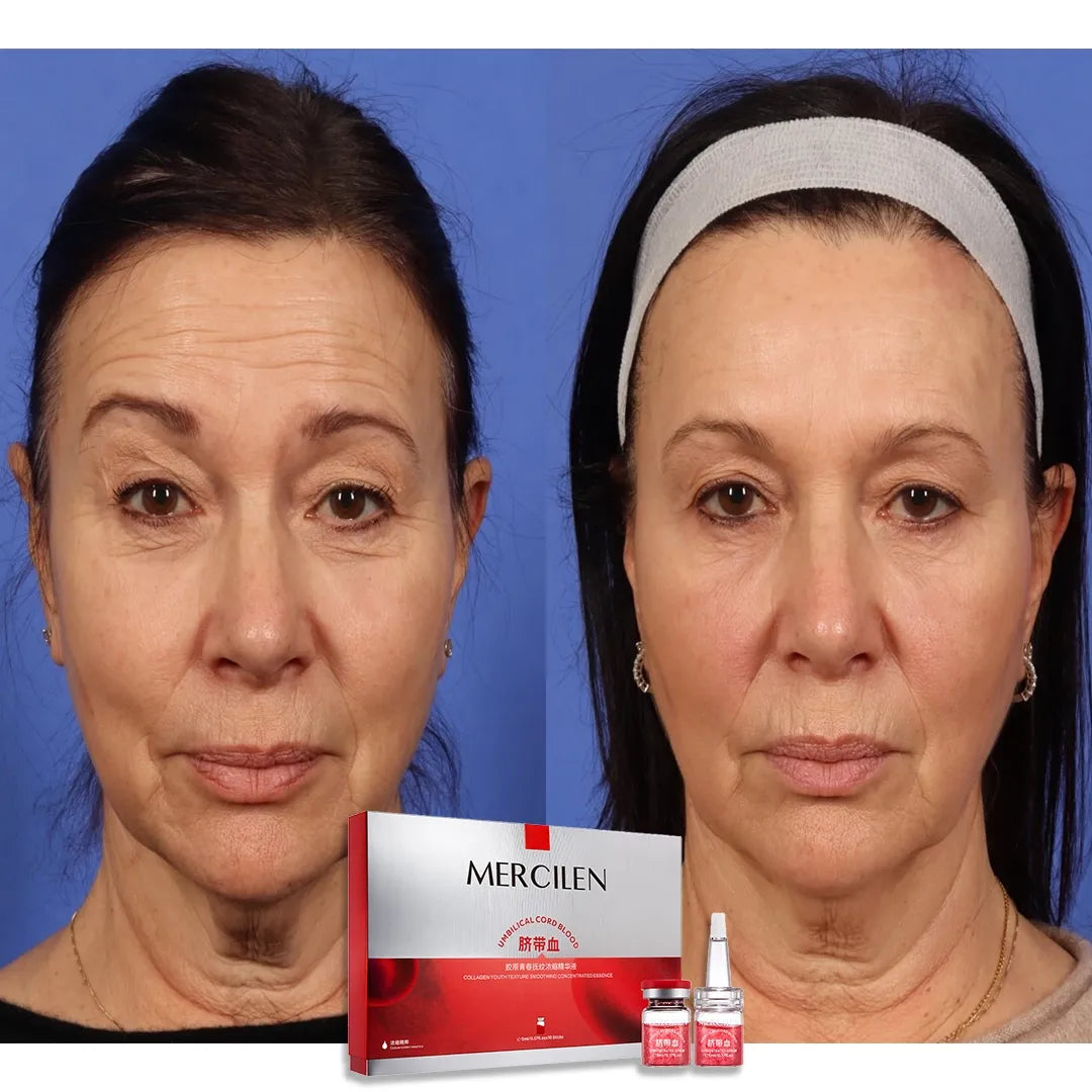 Ampułki kolagenowe przeciw zmarszczkom + tonik w prezencie