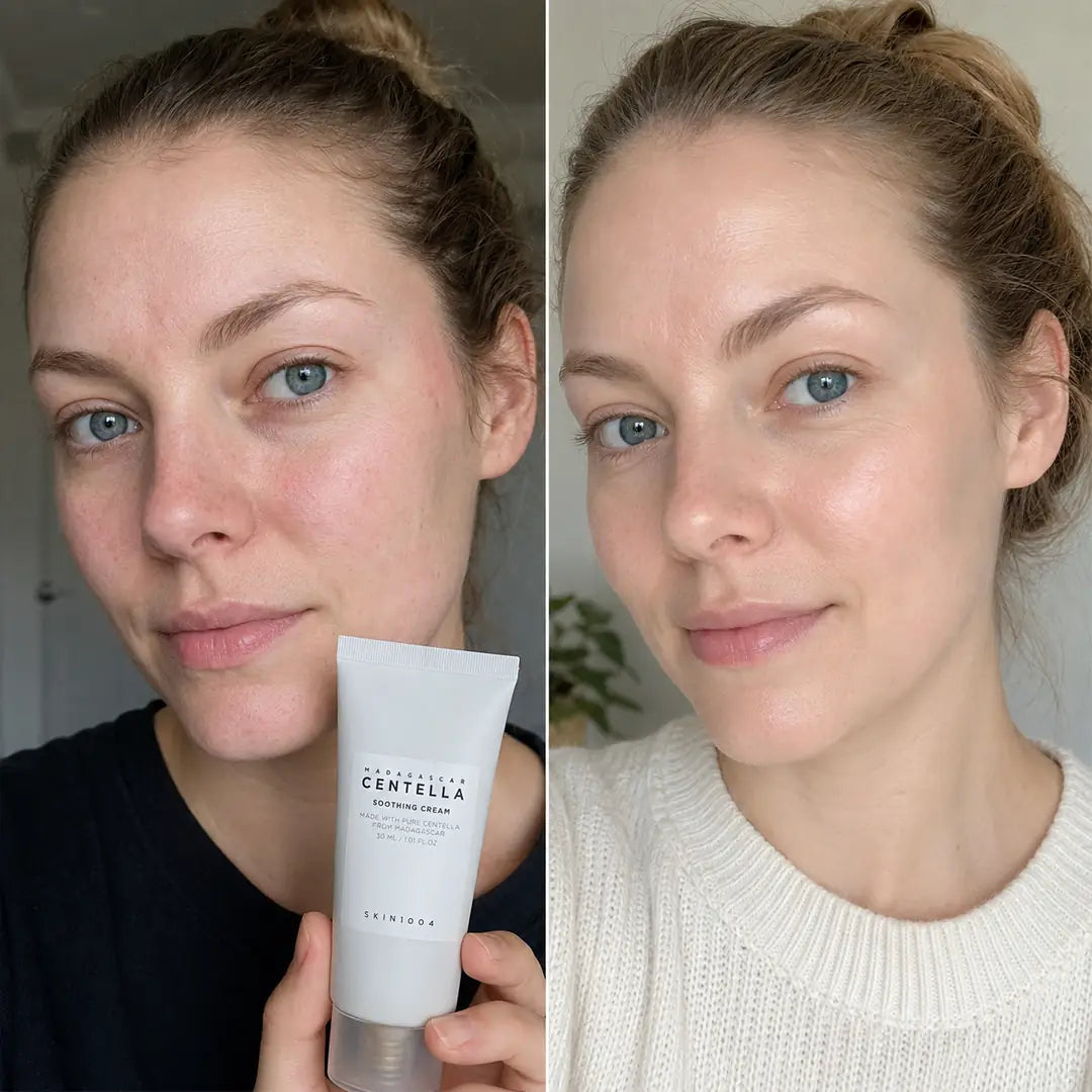 Kojący krem do twarzy z wąkrotą azjatycką SKIN1004 Madagascar Centella, 30 ml
