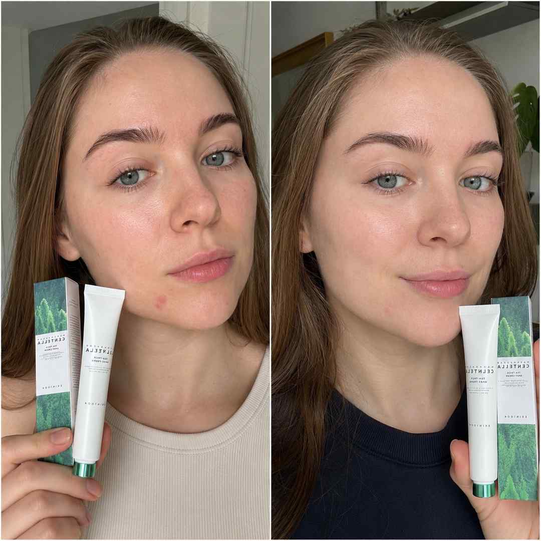 Krem punktowy na wypryski Skin1004 Tea-Trica Spot Cream 20 ml