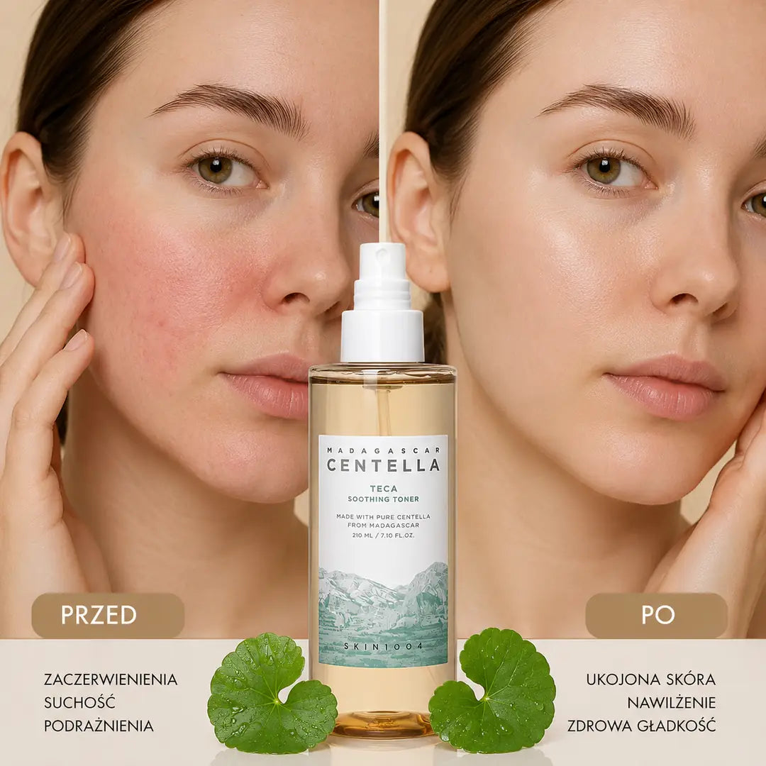 Intensywnie łagodzący toner do twarzy SKIN1004 Madagascar Centella Teca, 210 ml