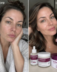 Dr.Melaxin Cemenrete Calcium Volume Set – umfassende Anti-Aging-Pflege mit Rebornic 10.000 ppm, Kollagen und Kalzium