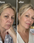 Kormesic Bee Venom veido kremas – bičių nuodai, raukšlių išlyginimas, 50 g