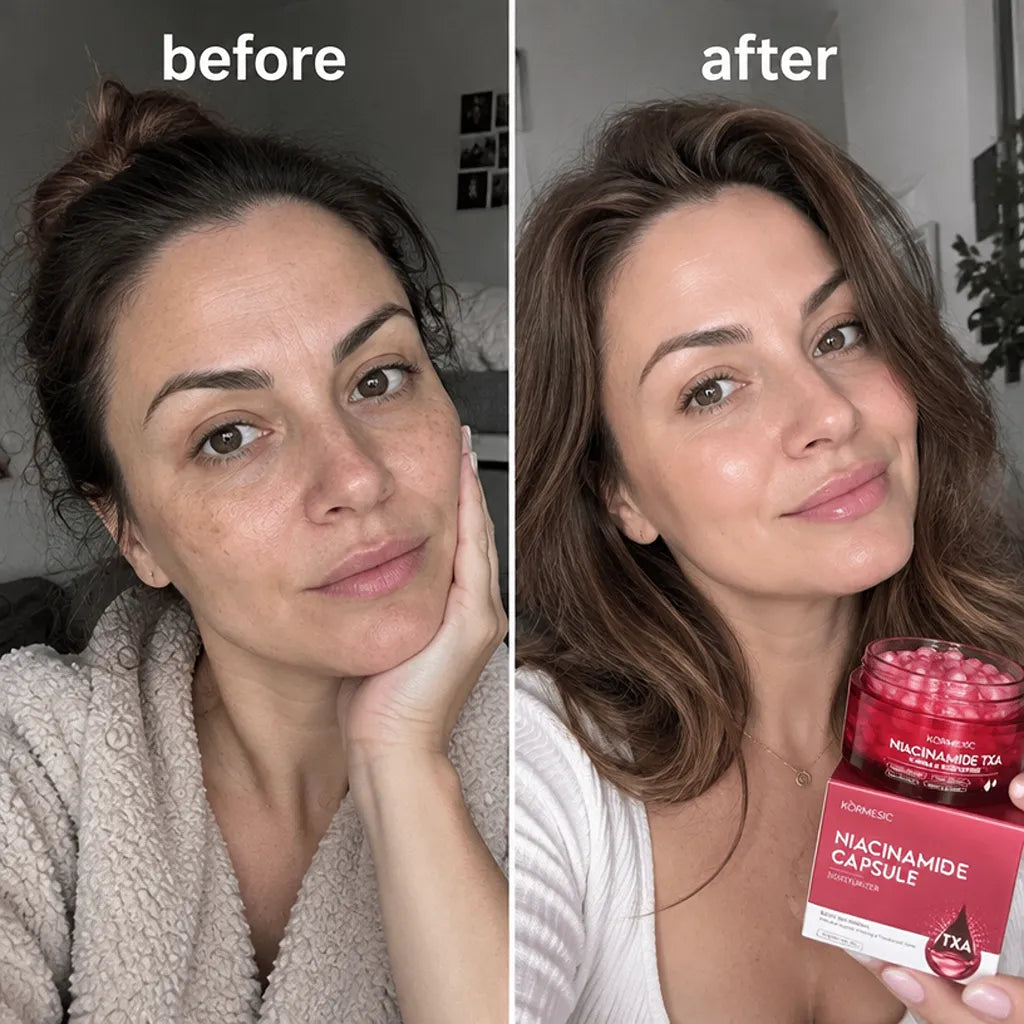Krem do twarzy Kormesic Niacinamide TXA Capsule Cream – rozjaśnienie, nawilżenie i wyrównanie kolorytu skóry 70 g