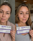 Serum do twarzy w ampułkach Kormesic Botoks Collagen – 5 ampułek - Serumy do twarzy